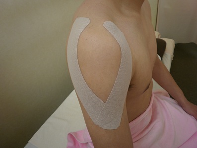 ���e�[�s���O